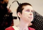 Una mujer vuelve a hablar tras 18 años gracias a un implante cerebral con IA